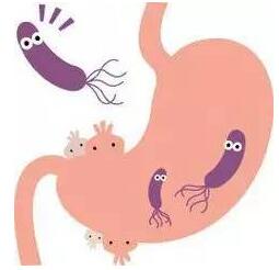1CD1